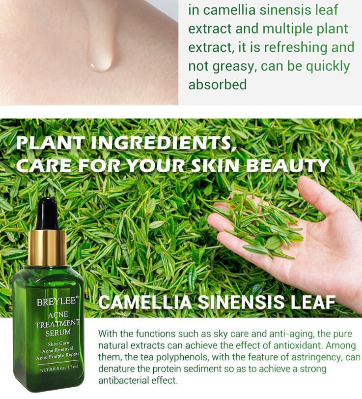 Buy Center Handpicked- Acne Treatment Serum Facial Repair Oil