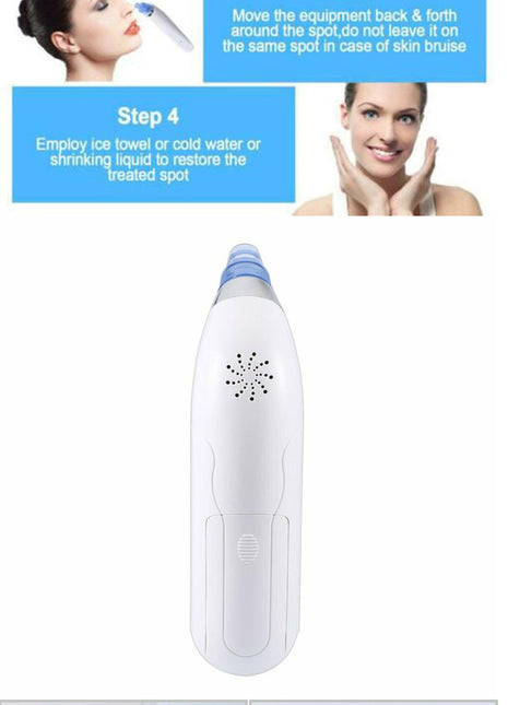 Blackhead Electric Pore Export Blackhead Cleaner