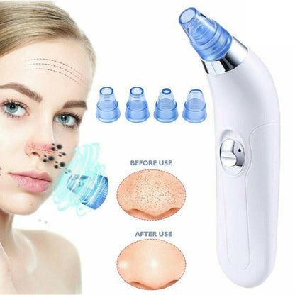 Nettoyeur de points noirs électrique pour pores Blackhead Export