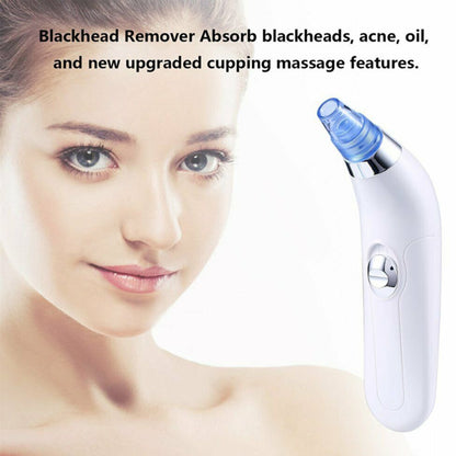 Nettoyeur de points noirs électrique pour pores Blackhead Export