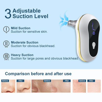 Buy Center Premium-Suction Blackhead Remover Kit Electric Facial Pore Cleanser Acne Cleaner