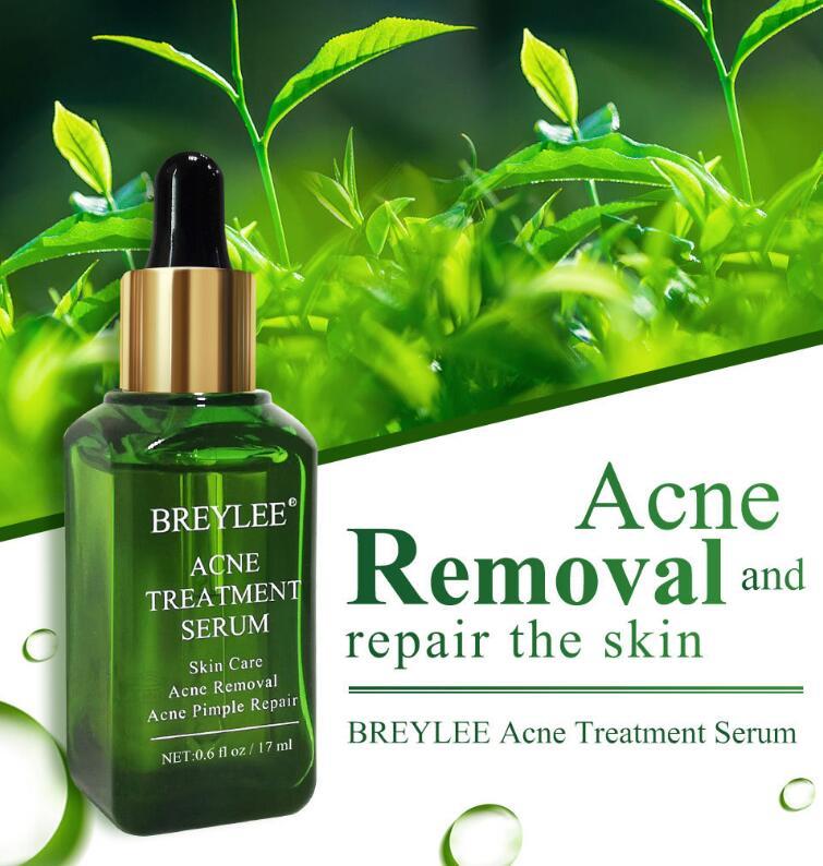 Buy Center Handpicked- Acne Treatment Serum Facial Repair Oil