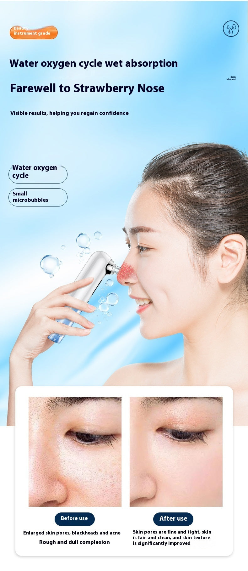 Newly Arrived at Buy Center: Electric Blackhead Removing Facial Pores Cleaner