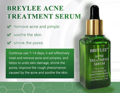 Buy Center Handpicked- Acne Treatment Serum Facial Repair Oil