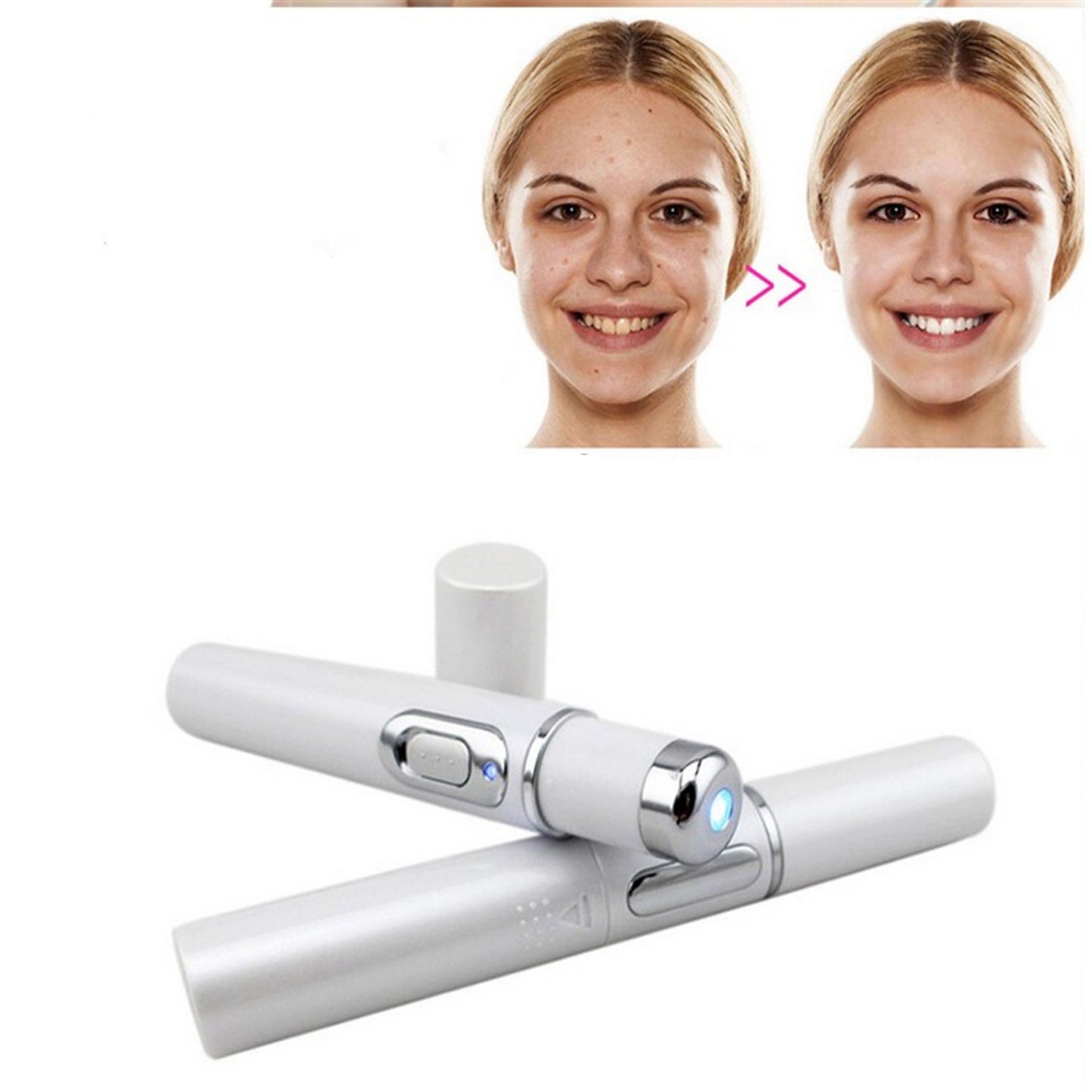 Buy Center Top Rated-Wrinkle Blemish Pore Acne Scar Remover Pen