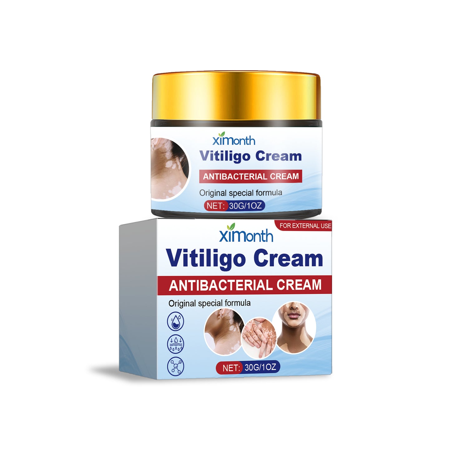 Buy Center Prestige-Vitiligo Antibacterial Cream 30g