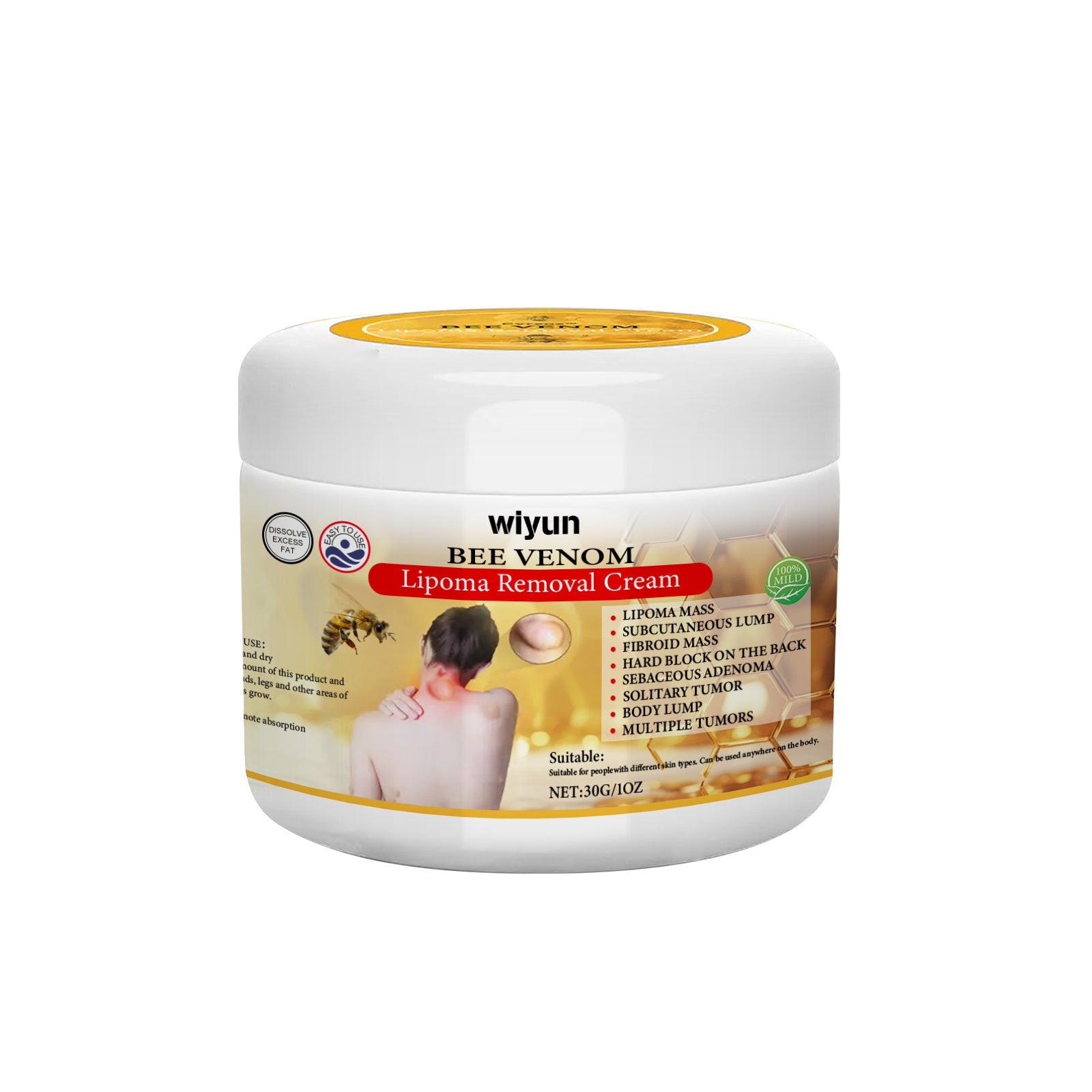 Buy Center Handpicked- Lipoma Removal Cream 30g